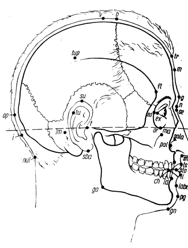 Punkty antropologiczne twarzy, widok z boku